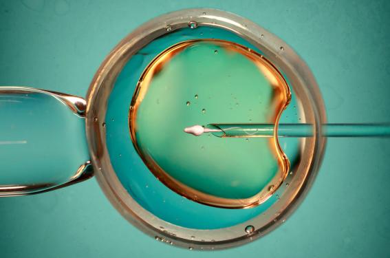 PMA pour toutes et conservation d’ovocytes hors raisons médicales : les décrets publiés PMA pour toutes et conservation d’ovocytes hors raisons médicales : les décrets publiés